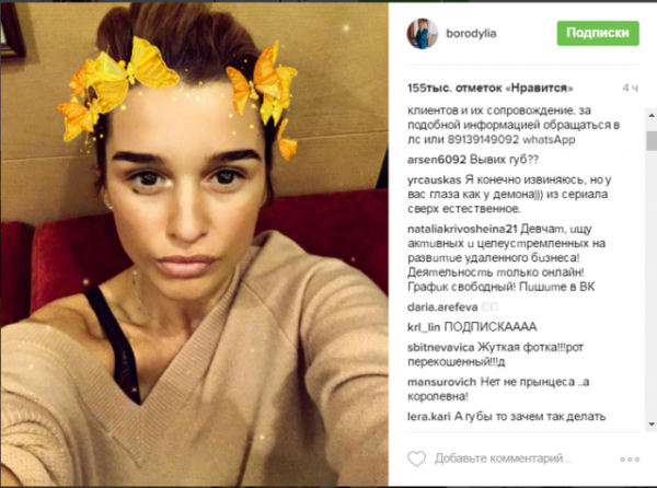 Ксения Бородина "вывихнула" губы ради селфи