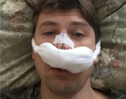 Ягудин напугал поклонников распушхим лицом